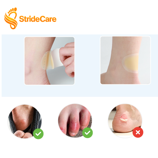 Blister Treatment Bandages for Feet – Prevent & Heal Blisters, Waterproof Anti-Blister Cushions for Heels, Toes, and Feet